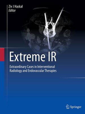 cover image of Extreme IR